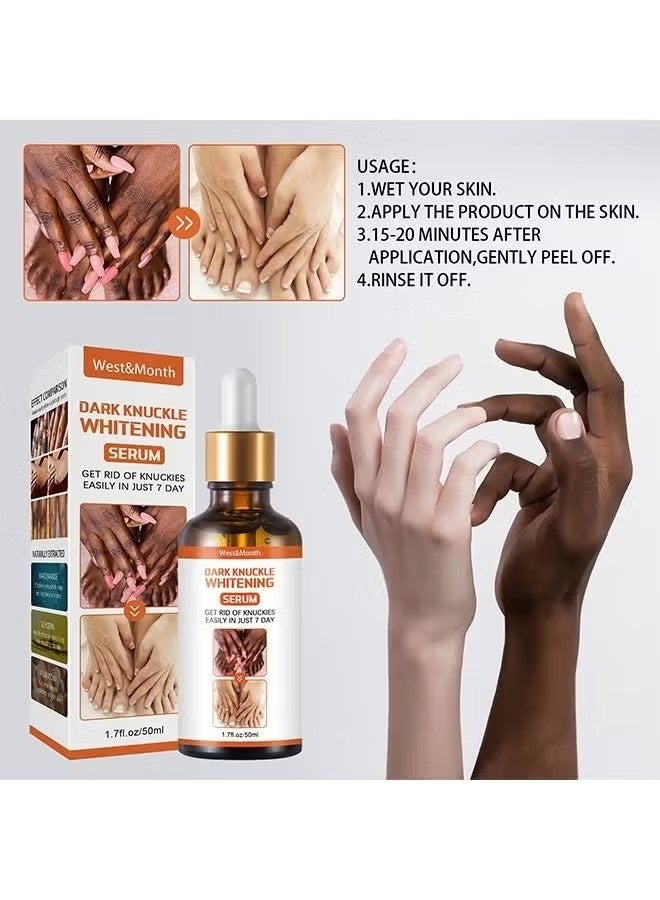 West&Month Dark knuckle Whitening Serum,7 days Treatment for Dark Spots in Hand and Feet Knuckles Exfoliating Improves Dullness Powerful Whitening Effect for Men and Women 50ml - Image 4